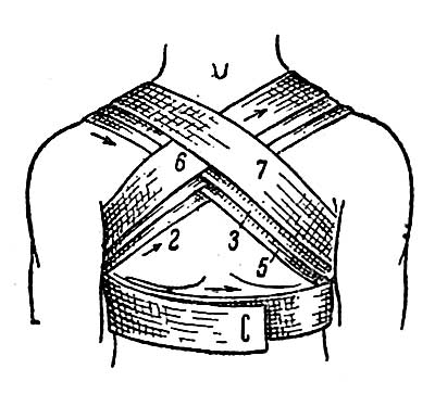 Крестовидная повязка на грудь